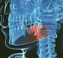 Facial Trauma Management