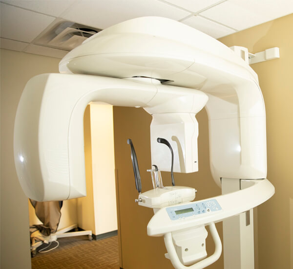 CBCT-Scans